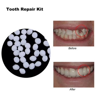 10g Geçici Diş Protez tamir kiti Diş Ve Boşluklar Yanlış Diş Katı Tutkal Protez Yapıştırıcı Diş Beyazlatma Diş Güzellik Aracı